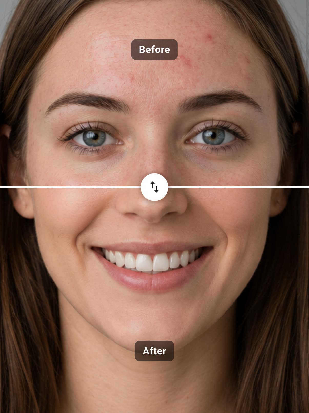 Before and after skincare close-up of a woman's face split by a horizontal wipe, blemished skin labeled Before on top and clear radiant skin labeled After below